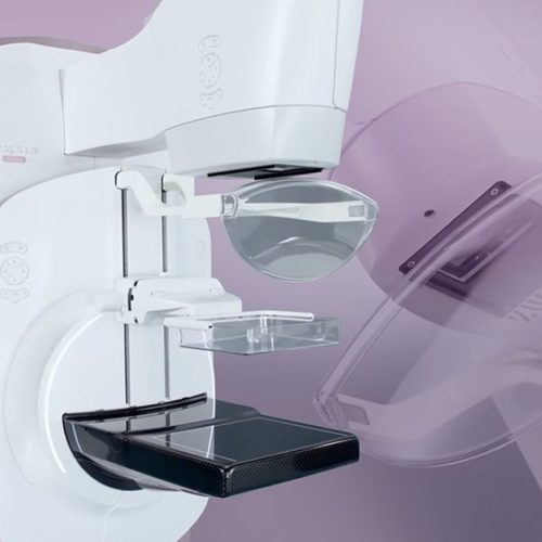 3D Mammography vs Digital Mammography
