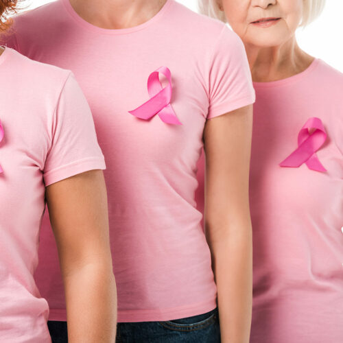 Do I really need a mammogram?